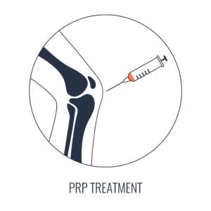 PRP Treatment
