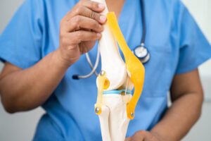 An ACL specialist holding human knee joint orthopedic anatomy model in hospital.